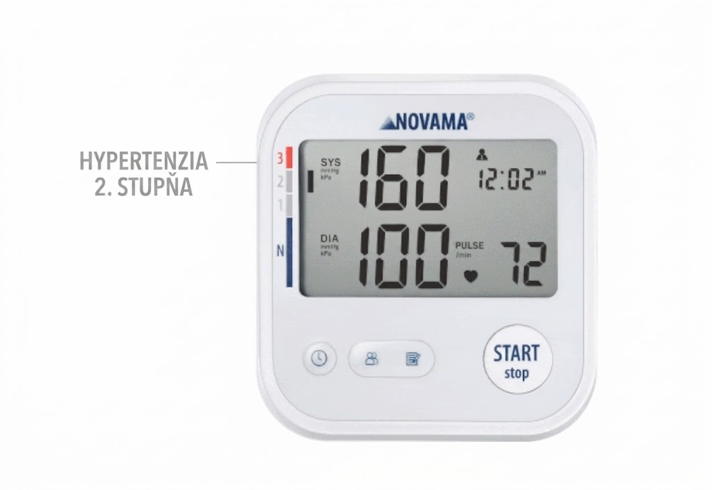 hypertenzia 2 stupňa